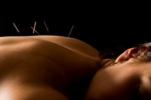 Acupuntura-em-Kingston-Natural-Health-Center