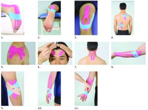 KINESIO4_copia.23334620_std