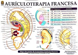 Auriculoterapia francesa_635905370542749880